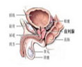 怎样才能预防前列腺肥大?
